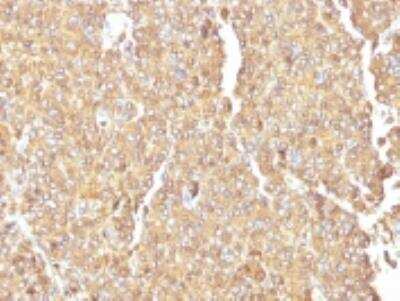 Immunohistochemistry-Paraffin: Chromogranin A Antibody (LK2H10) [NBP2-32956]