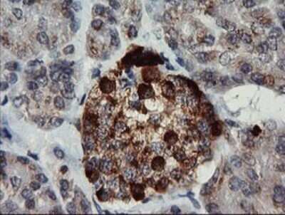 Immunohistochemistry: Chromogranin A Antibody (OTI2E12) - Azide and BSA Free [NBP2-70410]
