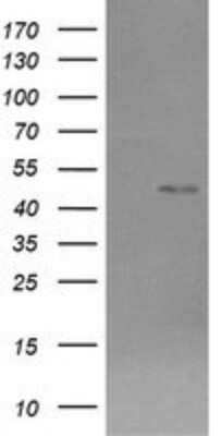 Western Blot: Chromogranin A Antibody (OTI2E12)Azide and BSA Free [NBP2-70410]