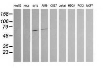 Western Blot: Chromogranin A Antibody (OTI2E12) [NBP2-46282]