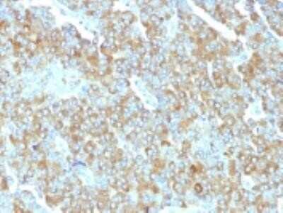 Immunohistochemistry-Paraffin: Chromogranin A Antibody (PHE5) - Azide and BSA Free [NBP2-34709]