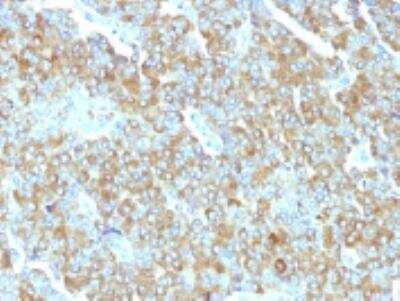 Immunohistochemistry-Paraffin: Chromogranin A Antibody (PHE5) [NBP2-32958]