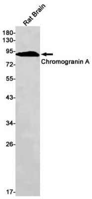 Western Blot: Chromogranin A Antibody (S04-4J4) [NBP3-19604]