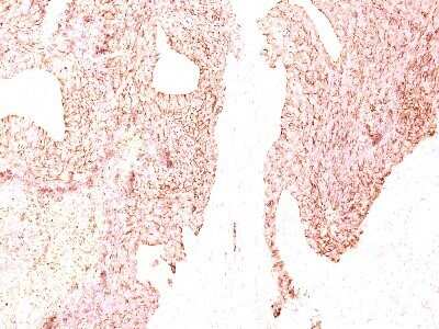 Immunohistochemistry-Paraffin: Chromogranin A Antibody (SPM339) - IHC-Prediluted [NBP2-44768]