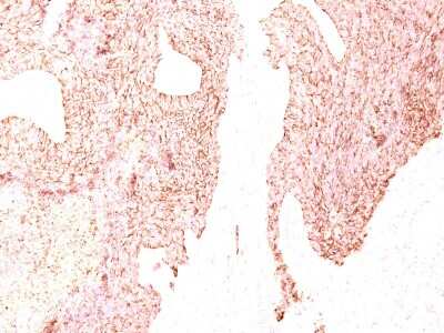 Immunohistochemistry-Paraffin: Chromogranin A Antibody (SPM339) [NBP2-32957]