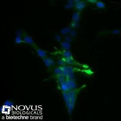 Immunocytochemistry/ Immunofluorescence: Chromogranin A Antibody (SPM553) - Azide and BSA Free [NBP2-34795]