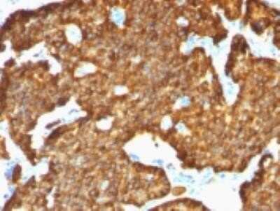 Immunohistochemistry-Paraffin: Chromogranin A Antibody (SPM553) - Azide and BSA Free [NBP2-34795]