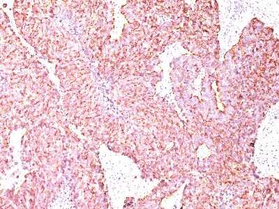 Immunohistochemistry-Paraffin: Chromogranin A Antibody (SPM585) - Azide and BSA Free [NBP2-34815]