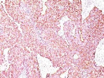 Immunohistochemistry-Paraffin: Chromogranin A Antibody (SPM585) - IHC-Prediluted [NBP2-44770]