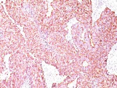 Immunohistochemistry-Paraffin: Chromogranin A Antibody (SPM585) [NBP2-32959]