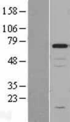 Western Blot: Chromogranin A Overexpression Lysate [NBL1-09149]