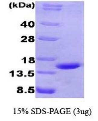 SDS-PAGE: Recombinant Human Chromogranin A Protein [NBC1-26369]