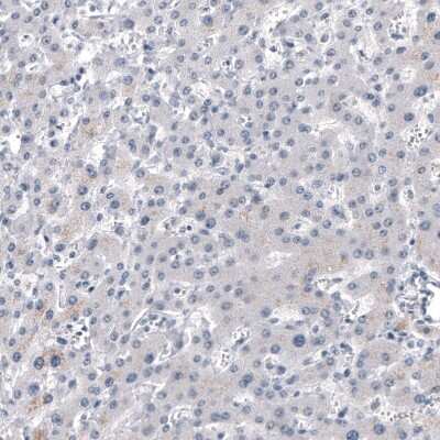 Immunohistochemistry-Paraffin: Chromogranin B Antibody (CL11404) [NBP3-15119]
