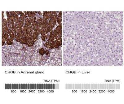 Immunohistochemistry-Paraffin: Chromogranin B Antibody [NBP1-80782]