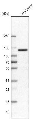 Western Blot: Chromogranin B Antibody [NBP1-80782]