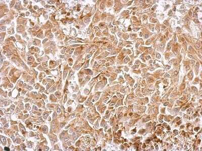 Immunohistochemistry-Paraffin: Chromogranin C Antibody [NBP2-15895]