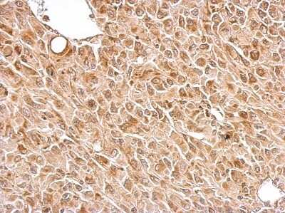 Immunohistochemistry-Paraffin: Chromogranin C Antibody [NBP2-15895]