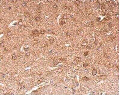 Immunohistochemistry-Paraffin: Chromogranin C Antibody [NBP2-15895]