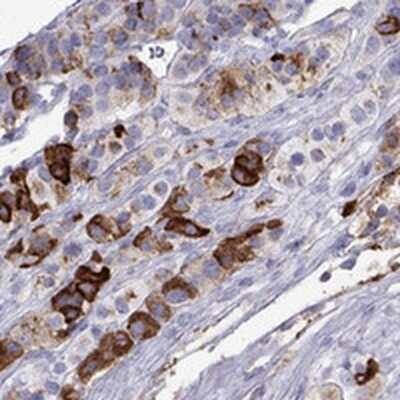 Immunohistochemistry-Paraffin: Chromogranin C Antibody [NBP2-62693]
