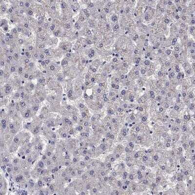 Immunohistochemistry-Paraffin: Chromogranin C Antibody [NBP2-62693]