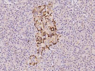 Immunohistochemistry-Paraffin: Chromogranin C Antibody [NBP2-99416]