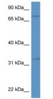 Western Blot: Chromogranin C Antibody [NBP1-91628]