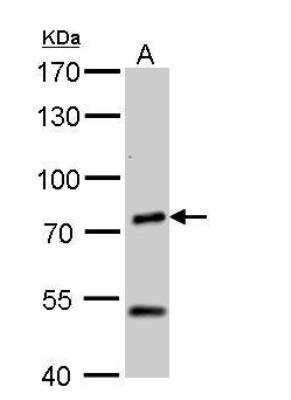 Western Blot: Chromogranin C Antibody [NBP2-15895]