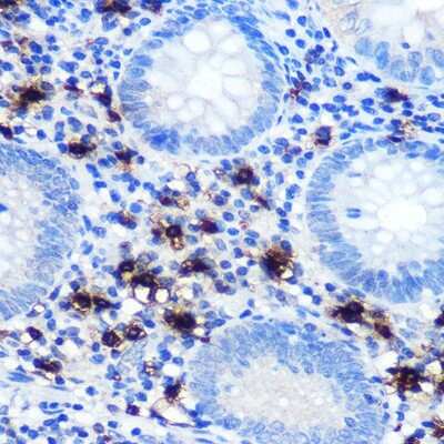 Immunohistochemistry-Paraffin: Chymase/CMA1/Mast Cell Chymase Antibody (2O4P8) [NBP3-15389]