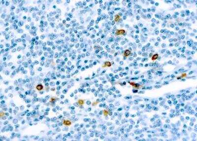 Immunohistochemistry: Chymase/CMA1/Mast Cell Chymase Antibody (CC1) [NB100-693]