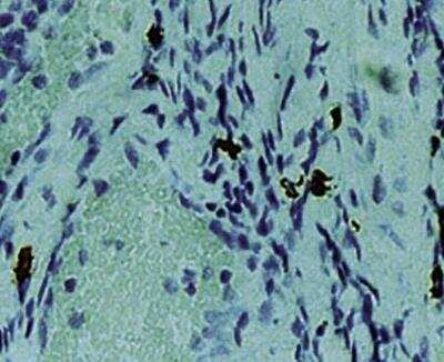 Immunohistochemistry-Paraffin: Chymase/CMA1/Mast Cell Chymase Antibody (CC1) [NB100-693]