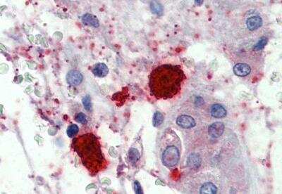 Immunohistochemistry-Paraffin: Chymase/CMA1/Mast Cell Chymase Antibody [NBP2-27551]