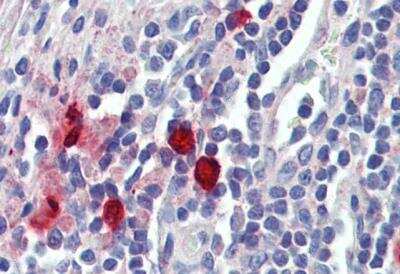 Immunohistochemistry-Paraffin: Chymase/CMA1/Mast Cell Chymase Antibody [NBP2-27551]