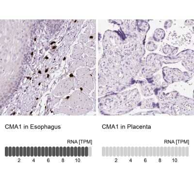 Immunohistochemistry-Paraffin: Chymase/CMA1/Mast Cell Chymase Antibody [NBP2-33660]