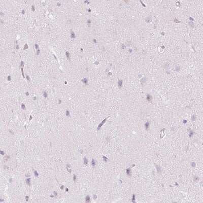 Immunohistochemistry-Paraffin: Chymase/CMA1/Mast Cell Chymase Antibody [NBP2-33660]