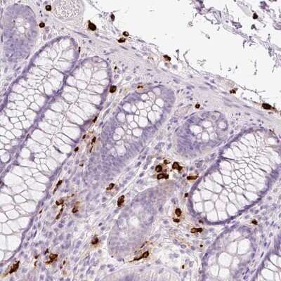 Immunohistochemistry-Paraffin: Chymase/CMA1/Mast Cell Chymase Antibody [NBP2-33660]