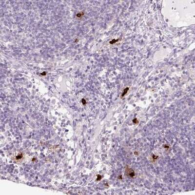 Immunohistochemistry-Paraffin: Chymase/CMA1/Mast Cell Chymase Antibody [NBP2-33660]