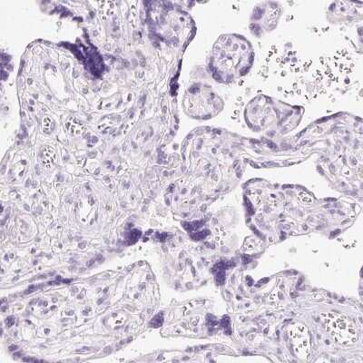 Immunohistochemistry-Paraffin: Chymase/CMA1/Mast Cell Chymase Antibody [NBP2-33660]