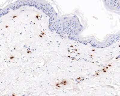 Immunohistochemistry-Paraffin: Chymase/CMA1/Mast Cell Chymase Antibody (JB74-32) [NBP2-75441]