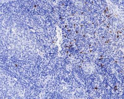 Immunohistochemistry-Paraffin: Chymase/CMA1/Mast Cell Chymase Antibody (JB74-32) [NBP2-75441]