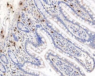 Immunohistochemistry-Paraffin: Chymase/CMA1/Mast Cell Chymase Antibody (JB74-32) [NBP2-75441]