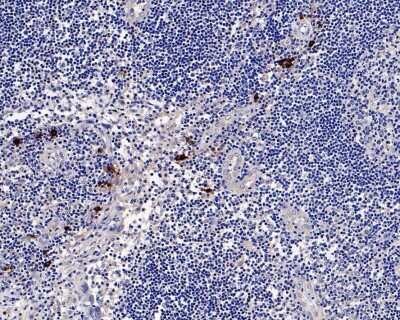 Immunohistochemistry-Paraffin: Chymase/CMA1/Mast Cell Chymase Antibody (JB74-32) [NBP2-75441]