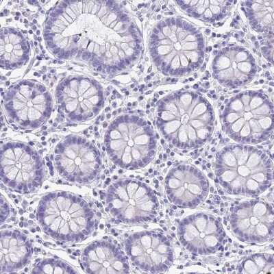 Immunohistochemistry-Paraffin: Chymotrypsin C/CTRC Antibody [NBP2-13882]