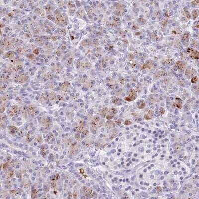 Immunohistochemistry-Paraffin: Chymotrypsin C/CTRC Antibody [NBP2-13882]