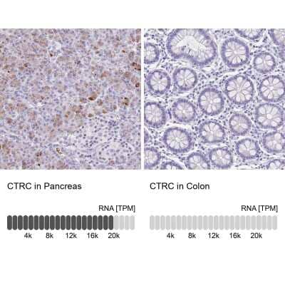 Immunohistochemistry-Paraffin: Chymotrypsin C/CTRC Antibody [NBP2-13882]