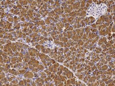 Immunohistochemistry-Paraffin: Chymotrypsin C/CTRC Antibody [NBP2-99799]