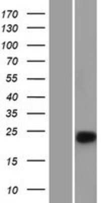 Western Blot: Chymotrypsin C/CTRC Overexpression Lysate [NBL1-09584]