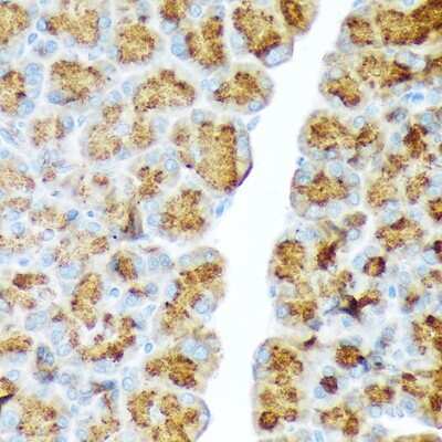 Immunohistochemistry-Paraffin: Chymotrypsin-like protease Antibody (10Z4K3) [NBP3-15845]