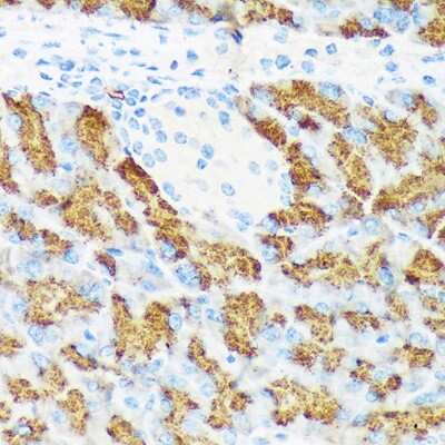 Immunohistochemistry-Paraffin: Chymotrypsin-like protease Antibody (10Z4K3) [NBP3-15845]