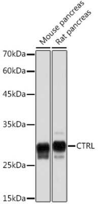 Western Blot: Chymotrypsin-like protease Antibody (10Z4K3) [NBP3-15845]