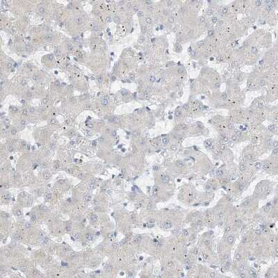 Immunohistochemistry-Paraffin: Chymotrypsin-like protease Antibody [NBP1-87520]